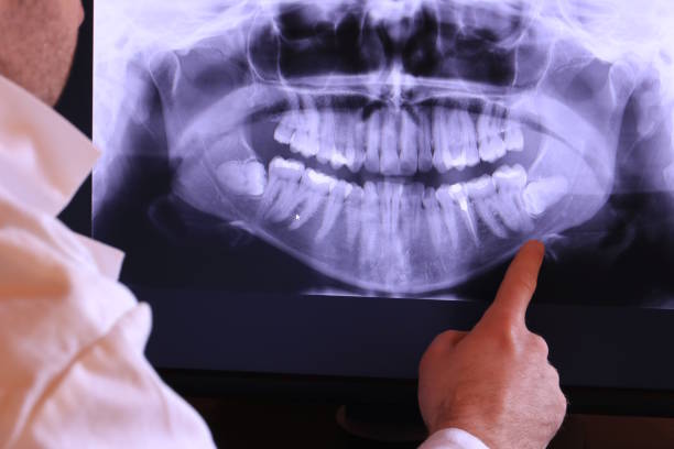 Best Emergency Treatment for Toothache in Merrimac, VA