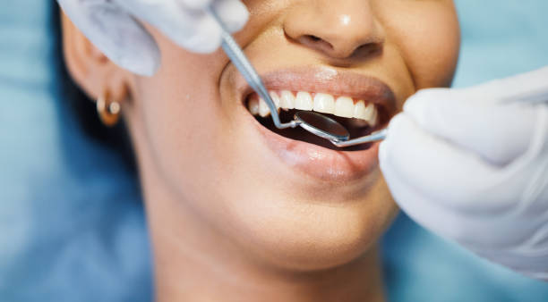 Best Emergency Wisdom Teeth Removal in Merrimac, VA
